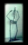 Cerebral Prostitute- 1991